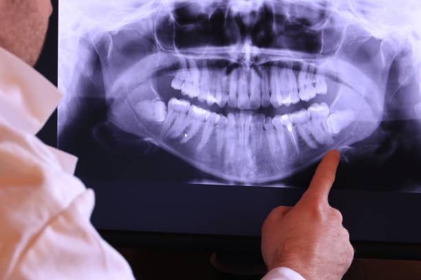 Best Emergency Root Canal Treatment in West Baraboo, WI