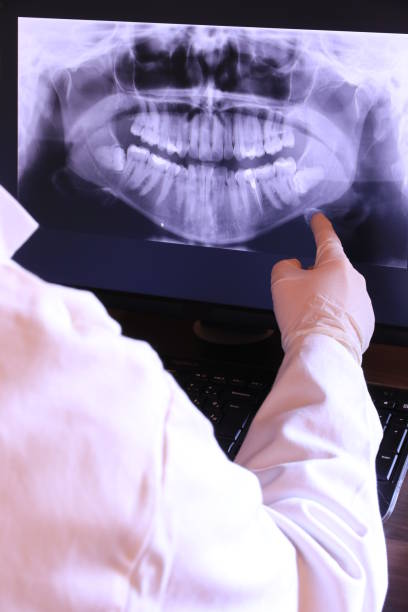 Best Emergency Treatment for Dental Infections or Abscesses in West Baraboo, WI