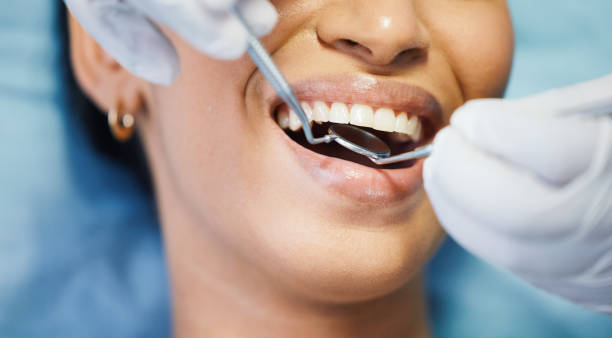 Best Emergency Gum Treatment in West Baraboo, WI