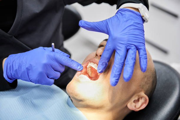 Best Emergency Tooth Extraction in West Baraboo, WI